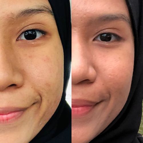 Customer photo review of Brightening Face Creme