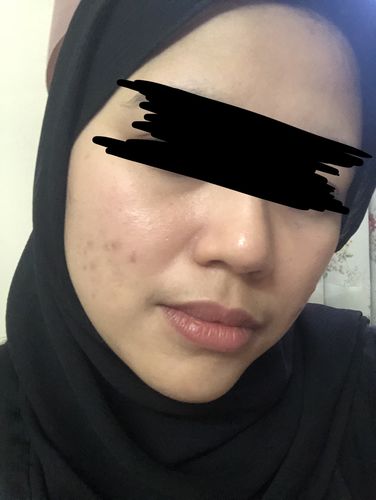 Customer photo review of Brightening Face Creme