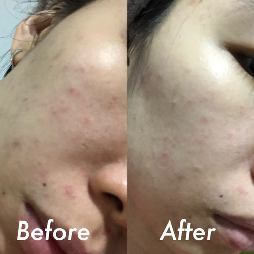 Customer photo review of POMEGRANATE INSTANT CALMING MASK (100g)