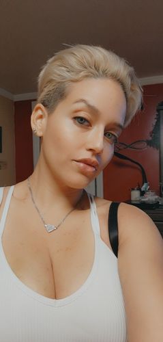 Customer photo review of LipFix: Filler