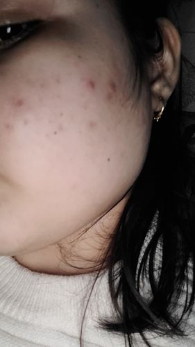 Customer photo review of Shadow SPF 50 + Cream