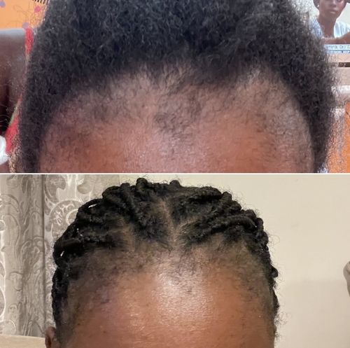 Customer photo review of Inches - Hair & Beard Oil