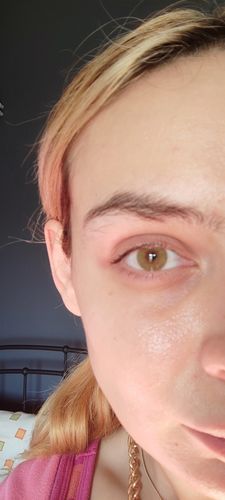 Customer photo review of Vision Green Contact Lenses(12 months wear)