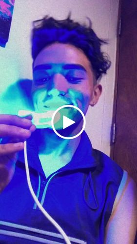 Customer video review of KIT INICIAL BLANQUEAMIENTO PREMIUM ILUMÍNATE - 3 Meses de Tratamiento