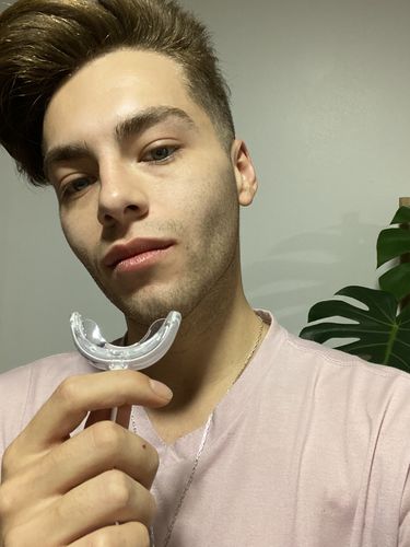 Customer photo review of Pack blanqueamiento Premium ILUMÍNATE + recargas extras / para 6 Meses de tratamiento