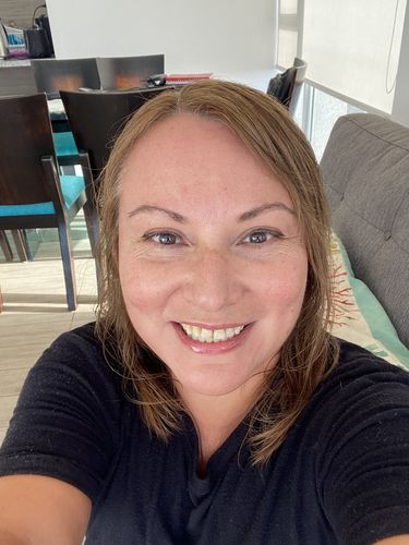 Customer photo review of KIT INICIAL BLANQUEAMIENTO DENTAL ILUMÍNATE - 3 Meses de Tratamiento