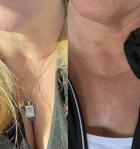 Customer photo review of True Meal Sample Pack (Variety Pack 3 Samples)