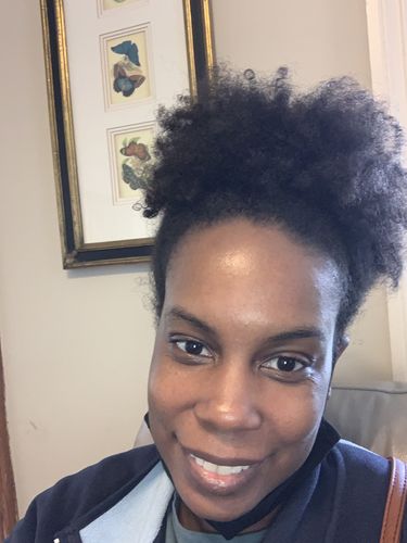 Customer photo review of BERRI-CLEAR+ 5 BERRY SUPERFRUIT SERUM