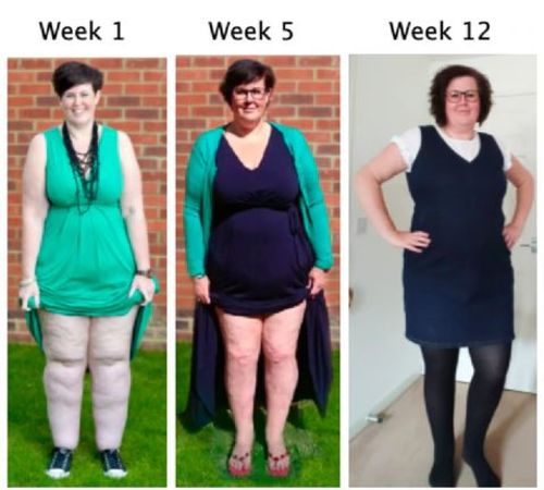 Customer photo review of PuriMe Lymphatic Drainage Ginger Foot Soak