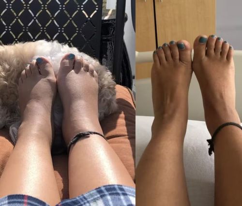 Customer photo review of PuriMe Lymphatic Drainage Ginger Foot Soak