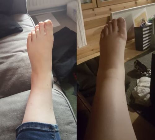 Customer photo review of PuriMe Lymphatic Drainage Ginger Foot Soak