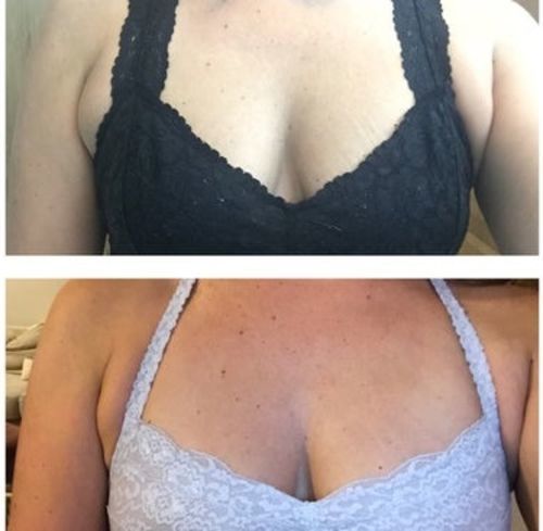 Customer photo review of LymphDetox Ginger Essential Oil