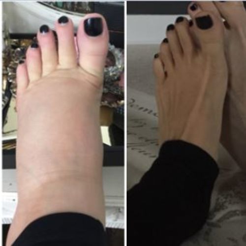 Customer photo review of LymphDetox Ginger Essential Oil