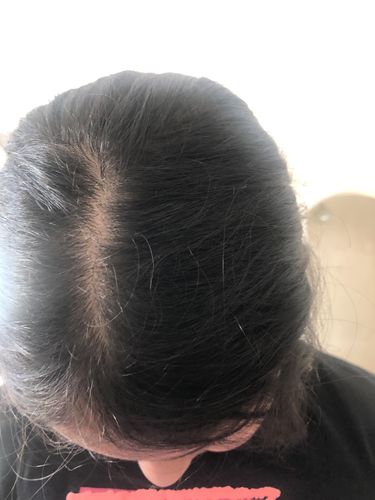 Customer photo review of Growth & Shine Hair Oil