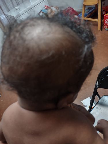Customer photo review of Kid's Hair Growth Scalp Stimulator