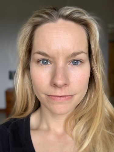 Customer photo review of Rosalique 3 in 1 Anti-Redness Miracle Formula SPF50