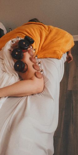 Customer photo review of Achedaway Cupper - The Smart Cupping Therapy Massager