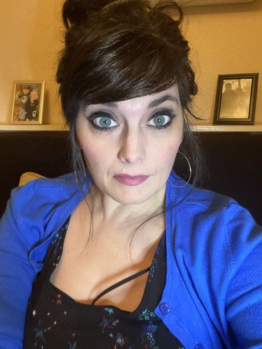Customer photo review of SL70 Blue Contact Lenses(12 months wear)