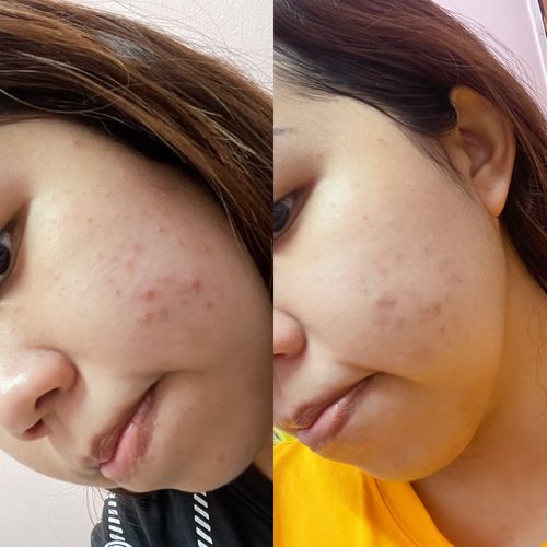 Customer photo review of POMEGRANATE INSTANT CALMING MASK (100g)