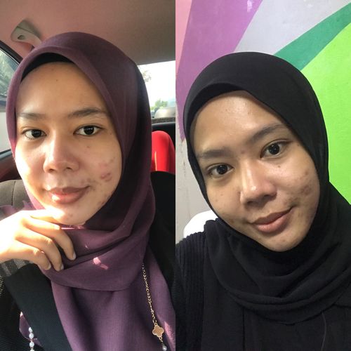 Customer photo review of Scar Repair Set