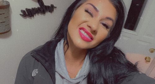 Customer photo review of GLO405™ Teeth Whitening Kit