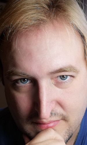 Customer photo review of Bloom Blue Contact Lenses(12 months wear)