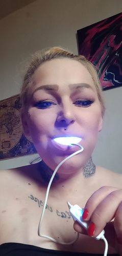 Customer photo review of Gratis Phonebleaching® X