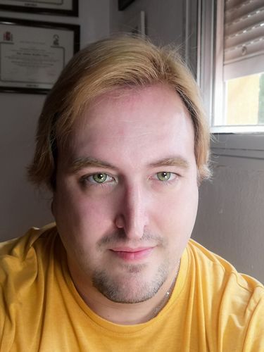 Customer photo review of Ginger Green Contact Lenses(12 months wear)