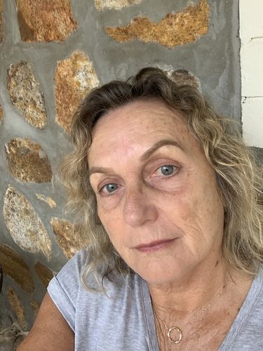 Customer photo review of Sea Buckthorn Serum