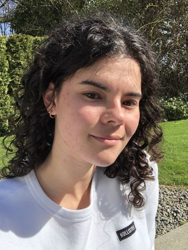 Customer photo review of Tiny Hoop Clip On Earrings in Gold