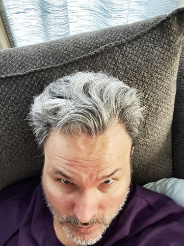Customer photo review of ZenScalp