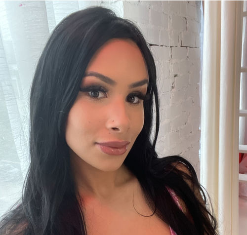 Customer photo review of JawlineFix: Filler