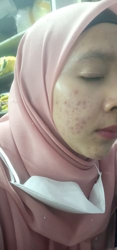 Customer photo review of Face Set