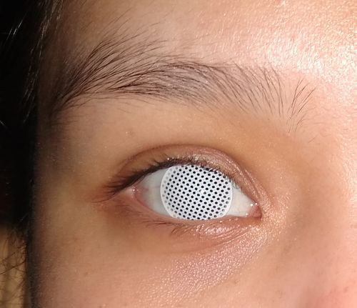 Customer photo review of White Mesh Contacts