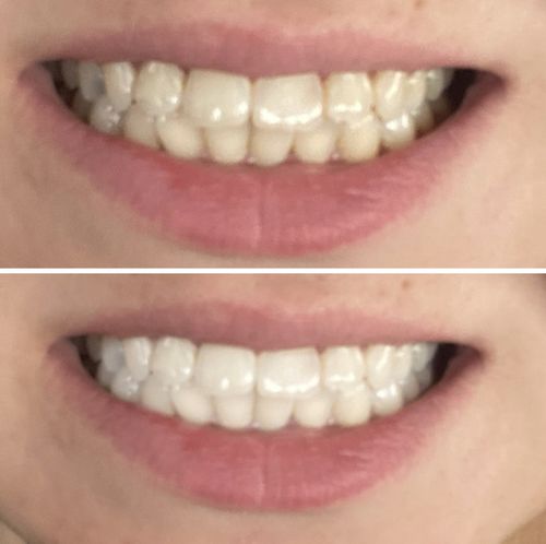 Customer photo review of Gratis 3x Einzelpen's