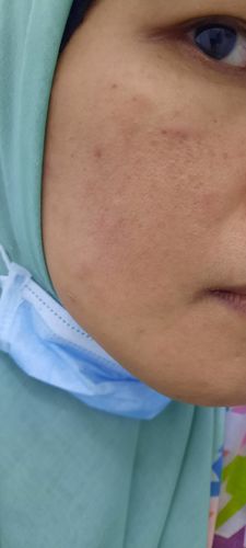 Customer photo review of Booster Set