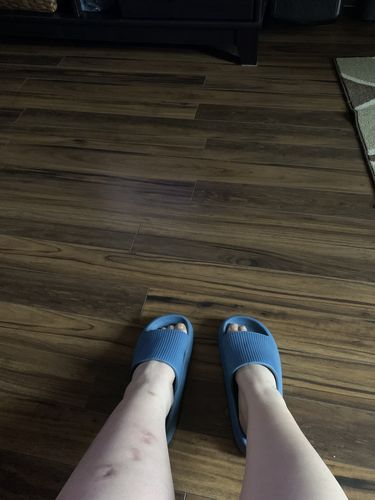 Customer photo review of Pantoufle orthopédique