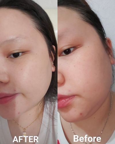Customer photo review of POMEGRANATE INSTANT CALMING MASK (100g)