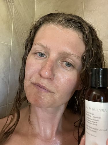 Customer photo review of Alpha Lyra | AHA/BHA Buffing Cleanser