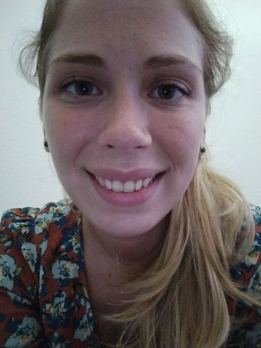 Customer photo review of GLO405™ Teeth Whitening Kit