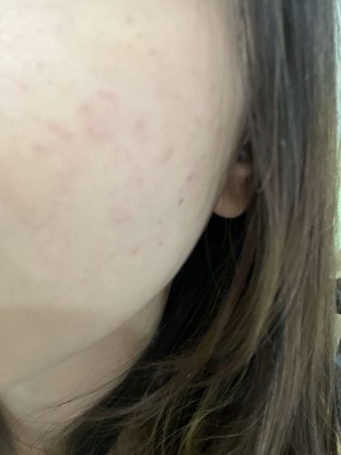 Customer photo review of Soothing Facial Cleanser