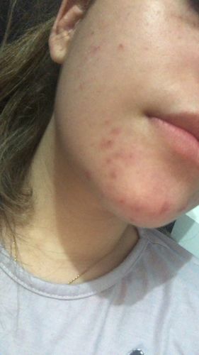 Customer photo review of Solução Retinol-Like
