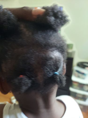 Customer photo review of Kid's Super healthy Hair kit