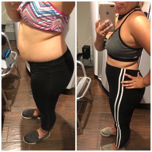 Customer photo review of Hot Sale - Herbal Slimming Patch(50% OFF 🔥 TODAY ONLY)