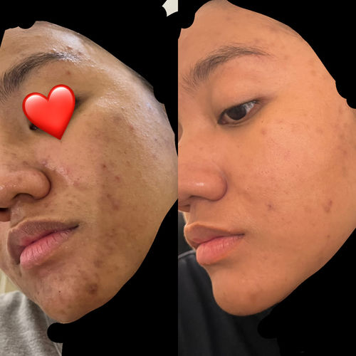 Customer photo review of Scar Repair Set