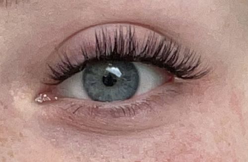 Kundenbewertung mit Foto zu Flutter Fling