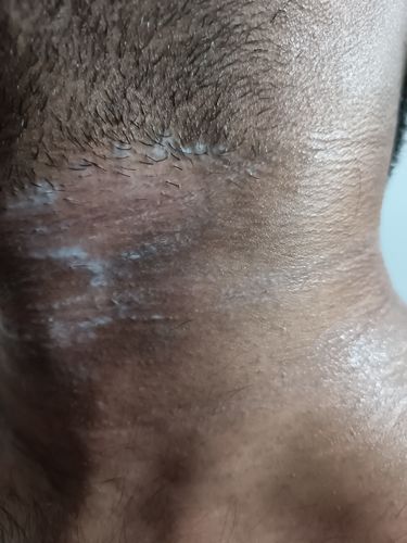 Customer photo review of Nigrifix Cream