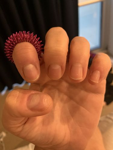 Customer photo review of Kaiko Spikey Finger Fidget Set of 5