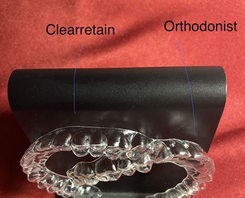 Customer photo review of File Your Smile (A Digital Record Of Your Teeth For Future Orders)