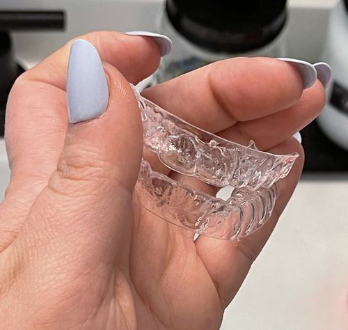 Customer photo review of Upper and Lower Retainers